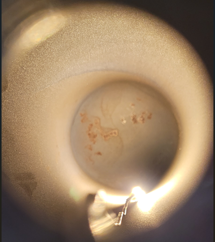 Before image